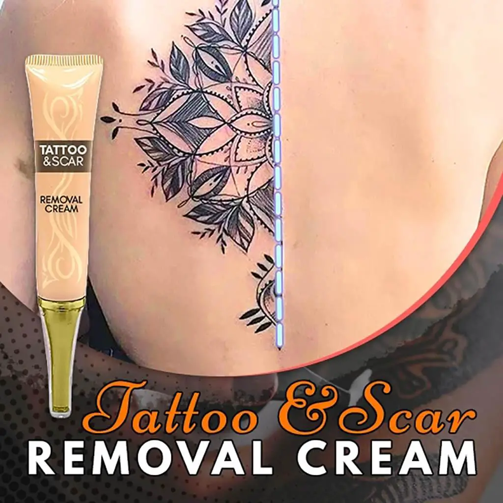 Tattoo Removal Creams: A Guide For Beginners LaserAll | Tattoo Removal Cream  Permanent Removal Of Tattoos Tattoo Removal Cream 